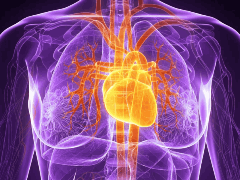 Risco de doença cardiovascular em longo prazo em sobreviventes de câncer de mama